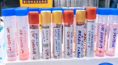 V Británii zaznamenali indický variant koronavírusu s dvojitou mutáciou