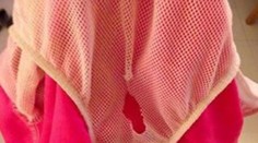 Nebezpečné plavky pripravili chlapca (5) skoro o penis. Skončil v nemocnici