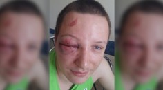 Napomenul dieťa na detskom ihrisku, takúto bitku za to dostal od jeho rodičov