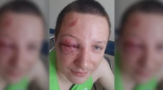 Napomenul dieťa na detskom ihrisku, takúto bitku za to dostal od jeho rodičov