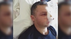 Na Nový rok brutálne dobili hasiča, tínedžer (17) sa priznal rodičom