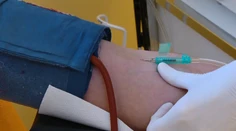 Odborníci varujú: Zásoby tejto krvnej skupiny sa u nás rýchlo míňajú