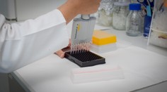 Rakúski a britskí vedci vyvinuli nový test. Ten pomôže včas odhaliť štyri druhy rakoviny