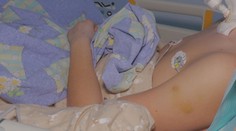 Poruchy vedomia a kolapsy. Deti čoraz viac skúšajú psychoaktívne látky, prípadov na urgente pribúda