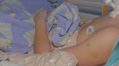 Poruchy vedomia a kolapsy. Deti čoraz viac skúšajú psychoaktívne látky, prípadov na urgente pribúda