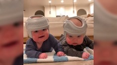 VIDEO: Bábätká nosia prilby takmer celý deň: Menej známa liečba rozdeľuje rodičov