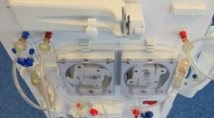 V Nitrianskom kraji sa objavilo podozrenie na nebezpečné ochorenie SARI