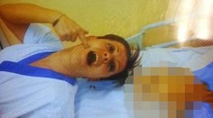 Talianskom otriasa nechutný prípad. Sestra zabila 38 pacientov a fotila sa s nimi