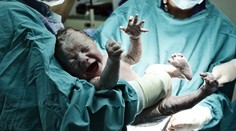 V ktorej pôrodnici robia najčastejšie cisársky rez? Ich počet na Slovensku narástol