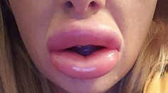 Chcela sexy pery: Namiesto nich dostala dve surové klobásky