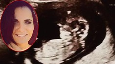 Farmárka Nikola Komorová a jej partner prezradili pohlavie bábätka