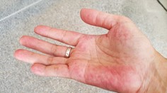 Únava nemusí prísť len s jesenným počasím. Tichého zabijaka indikujú viaceré príznaky