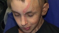 Na chlapca je hrozný pohľad. Môže za to ťažká choroba