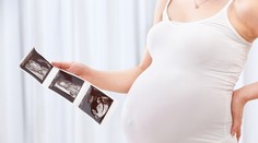 Nová zarážajúca štúdia: Na kávu počas tehotenstva radšej zabudnite