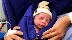 V Brazílii sa narodilo prvé dieťa z transplantovanej maternice mŕtvej ženy