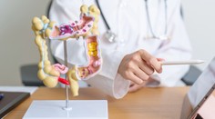 Najväčší nárast prípadov rakoviny hrubého čreva je medzi mladými. Tieto varovné signály nepodceňujte