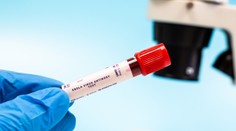 Ako sa prenáša ebola? Infektológ vysvetlil príznaky aj úmrtnosť