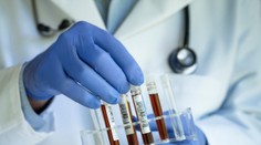 Vedci skúmali krv ľudí, ktorí sa dožili 100 rokov. Zistili, že všetci majú niečo spoločné