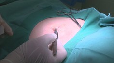 Znamienko si môžete dať vybrať aj v lete: Zisťovali sme, čo všetko s tým súvisí