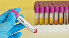 V Bratislavskom kraji zaznamenali jeden prípad nebezpečného ochorenia