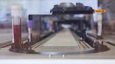 Chaos s testovaním na nový koronavírus. Niektorí naň čakali aj desať dní