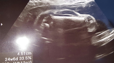 Muž bol po ultrazvuku v šoku. Týmto príspevkom pobúril internet