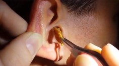 Umýval si tento muž niekedy uši? To, čo mu z jedného vytiahnu, je nechutné