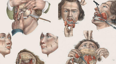 Len pre silné povahy. Takto vyzerali operácie pri plnom vedomí