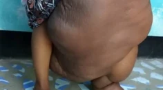 Na ženu s chorou gigantickou nohou sa usmialo šťastie