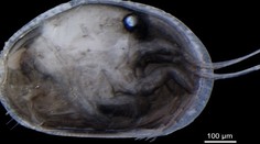 Vedci našli najstaršie spermie na svete. Takto vyzerajú