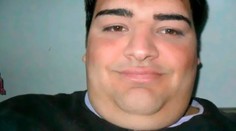 Podstúpil 27 operácií, aby vyzeral ako Ricky Martin. Takýto je výsledok