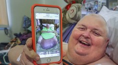 Z vrasteného chlpu vznikol 60-kilový nádor. Lekári mu hovorili, že je iba tučný