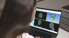 Mladá vedkyňa zo Slovenska mení pohľad na starnutie: Takto chce bojovať s Alzheimerom
