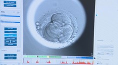 Alarmujúca situácia na Slovensku: Neplodný je každý siedmy pár. Čoraz viac vyhľadávajú pomoc reprodukčných kliník