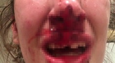 Šokujúce fotografie z Facebooku. Takto ju doriadil priateľ