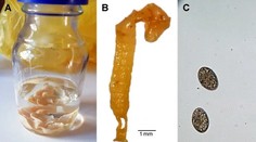 V Česku sa prvýkrát objavila nebezpečná choroba. Zrejme ju tam zavliekol turista