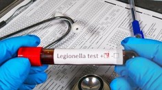 V hotelovej vírivke v Demänovskej Doline potvrdili prítomnosť baktérie Legionella