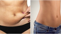 7 cvikov, aby ste po Vianociach nevyzerali ako muffin