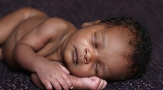 Dvojčatá sa narodili na dvoch rôznych miestach a v rôzne dni