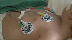 Prvá obeť čierneho kašľa v tomto roku. Zomrel mesačný chlapček z Revúcej