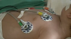 Prvá obeť čierneho kašľa v tomto roku. Zomrel mesačný chlapček z Revúcej