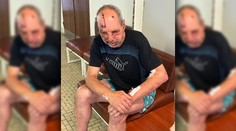 Medvedica sa mužovi v Kremnických vrchoch zahryzla do čela. V nemocnici nám opísal útok