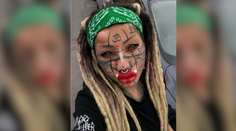 FOTO: Svojím vzhľadom poburuje ľudí. „Ľudská mačka“ s úpravami ani zďaleka nekončí