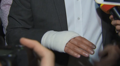 Richard Sulík objasnil, ako sa zranil