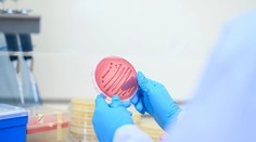 Nebezpečná kvasinka zabíja až 60 % infikovaných. Prvé prípady potvrdili už aj u našich susedov