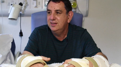 Unikátny zákrok, transplantácia rúk vrátila mužovi dôstojnosť