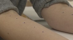 Vedeli ste, že na testy na alergiu nemusíte čakať do zimy?