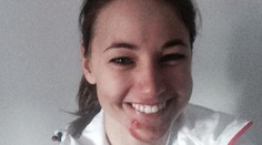 Už sa to začína. Naši hlásia prvé zranenia