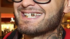 Môžete trikrát hádať, komu patrí tento zlatý úsmev