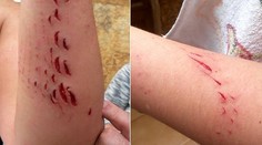 V obľúbenej dovolenkovej destinácii Slovákov útočil žralok